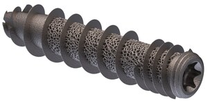 Cutting Edge Spine Announces Notice of Issuance from the U.S. Patent and Trademark Office regarding Patent No. US 11,771,482 B2: IMPLANTS FOR TISSUE FIXATION AND FUSION