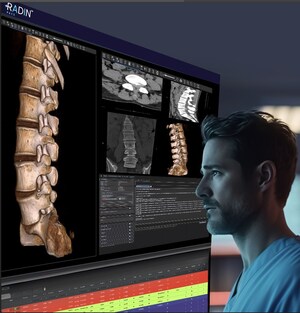 Revolutionizing Healthcare: Radin Health Unveils Cutting-Edge AI-Empowered Cloud Solution for Radiology and Workflow Efficiency