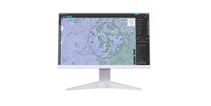 <em>AI-Powered</em> Tumor Microenvironment Analysis Predicts Treatment Outcomes in NSCLC Patients with EGFR Mutation: Groundbreaking Studies to be Presented by Lunit at SITC 2023