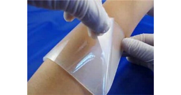 Incheon National University Scientists Develop New Hydrogels for Wound Management