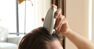 Rootique DUO launches on Indiegogo, revolutionizing hair loss treatment with a 15s mess-free process