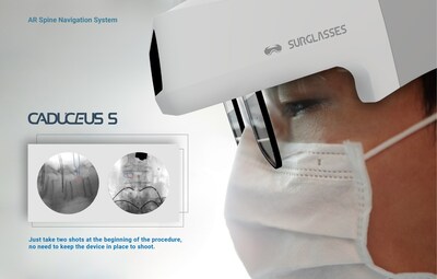 SURGLASSES Caduceus S augmented reality spinal surgery navigation system requires only 2-4 X-rays for navigation.
