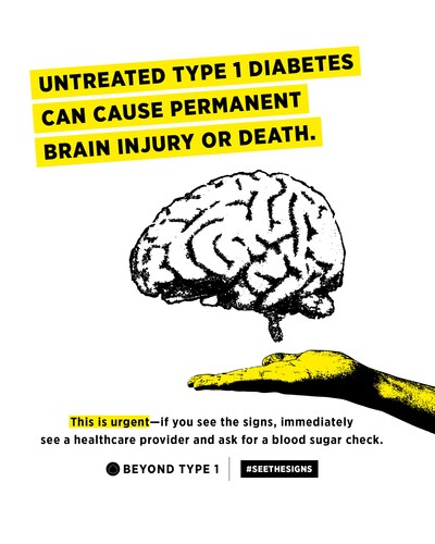 Symptoms of diabetes include excessive thirst, frequent urination, exhaustion and unexplained weight loss. For those living with type 1 diabetes, the symptoms can quickly turn into a life-threatening condition called diabetic ketoacidosis (DKA), which can result in what is known as a “diabetic coma.”