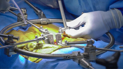 Phantom AL Anterior Lumbar Access System from TeDan Surgical Innovations