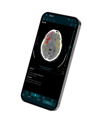 Brainomix 360 e-ASPECTS on a smartphone - an FDA-cleared decision support tool for assessing stroke signs on plain CT brain scans
