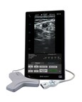 BD Launches Advanced Vascular Access Ultrasound System Designed to Improve Clinician Efficiency