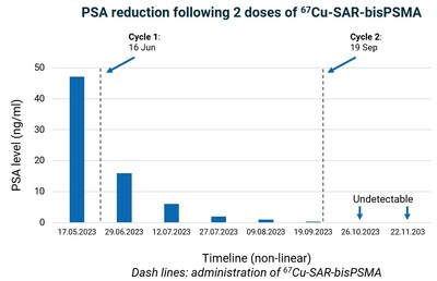 Figure 3. PSA dynamics over time. Series of PSA test results show baseline and decrease over time after the administration of one cycle of Cu-67 SAR-bisPSMA. PSA level was undetectable in the last 2 measurements after the second cycle of Cu-67 SAR-bisPSMA. Lower level of detection: 0.05 ng/ml.