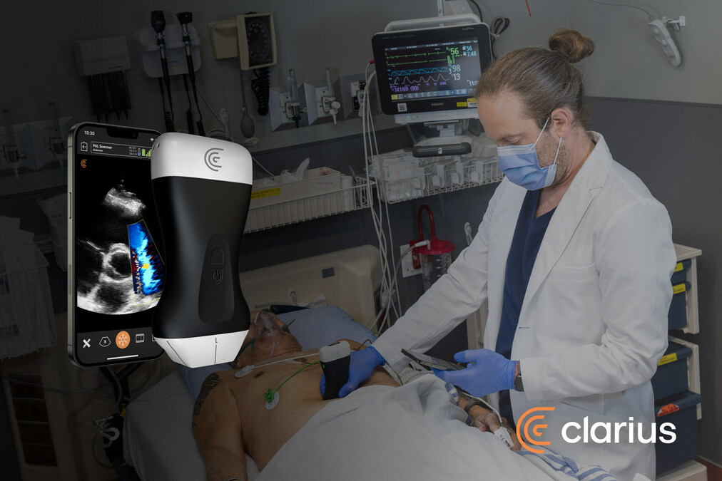 Clarius Awarded Technology Breakthrough Designation in Ultrasound Category with Premier, Inc. - Vimarsana News
