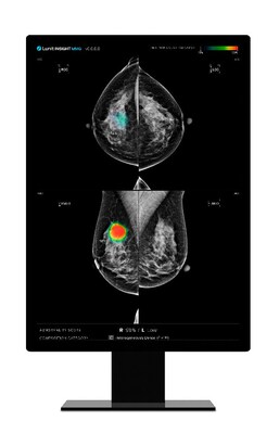 Lunit's AI-powered mammography analysis solution 'Lunit INSIGHT MMG'