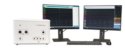 ECGenius 3.1 is an advanced version of the ECGenius System software. The new version improves workflow and streamlines processes to accelerate adoption as electrophysiologists integrate AI analyses into the EP lab, increasing the demand for high-quality signal data