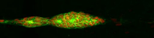 Pictured here is a group of cells moving toward its correct final position in the tail of a forming zebrafish embryo. Cell membranes are green and the cell nuclei red.