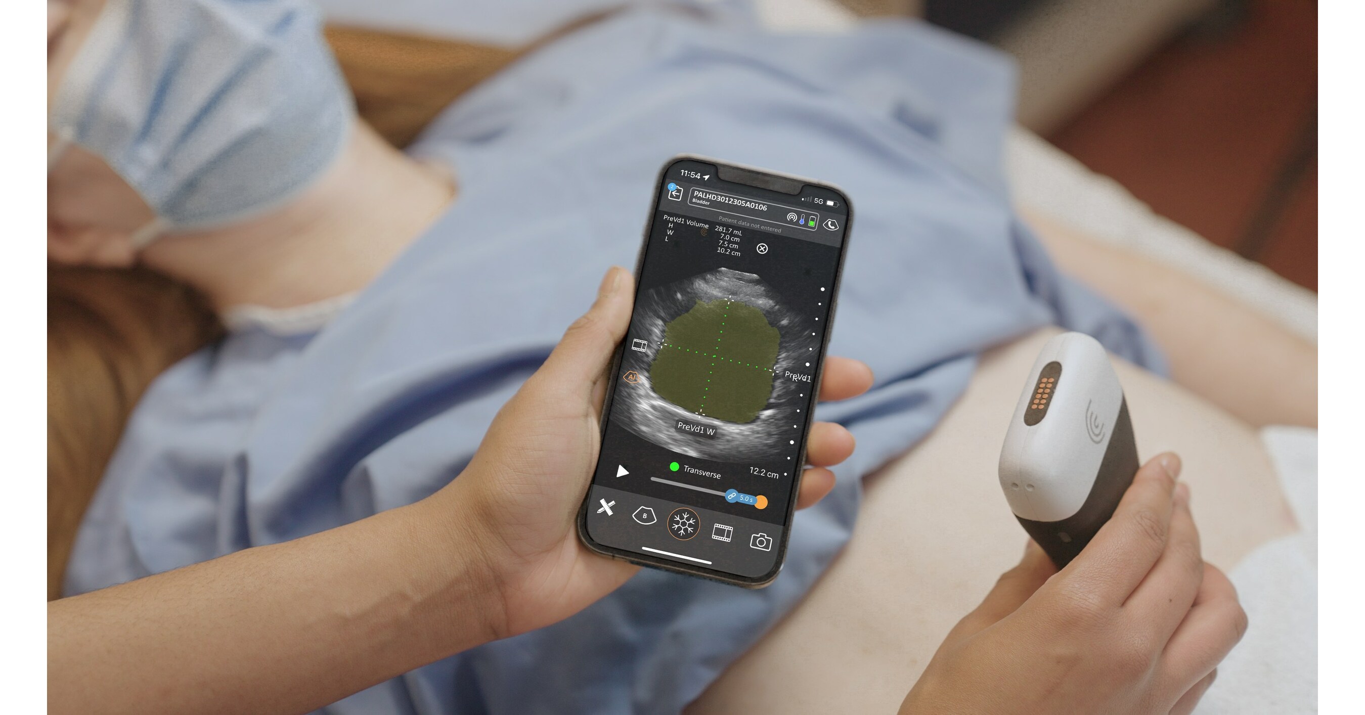 Clarius Adds AIDriven Automatic Bladder Volume Measurements to its