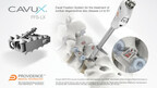 Providence Medical Technology Announces FDA Clearance of CAVUX® FFS-LX Lumbar Facet Fixation System for 1- and 2-Level Lumbar Spinal Fusion