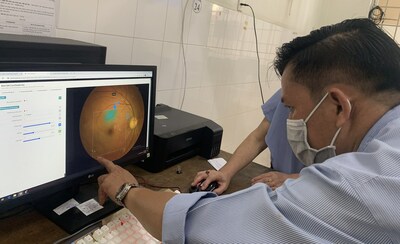 Dr. Hieu uses Orbis's Cybersight AI platform to detect diabetic retinopathy and other blinding eye diseases at My Tho district health center in Vietnam. Photo: Orbis International