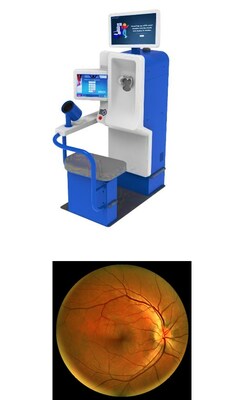 Top: The Pursuant Health Kiosk allows users to measure their own blood pressure, pulse rate, & weight, and capture images of their retina to share with healthcare professionals. Bottom: A sample retinal image captured at the kiosk.