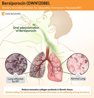Daewoong Pharmaceutical's Bersiporocin Receives ‘Orphan Drug Designation’ in Europe to Treat Idiopathic Pulmonary Fibrosis