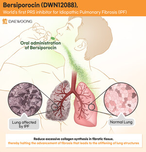Daewoong Pharmaceutical's Bersiporocin Receives 'Orphan Drug Designation' in Europe to Treat Idiopathic Pulmonary Fibrosis