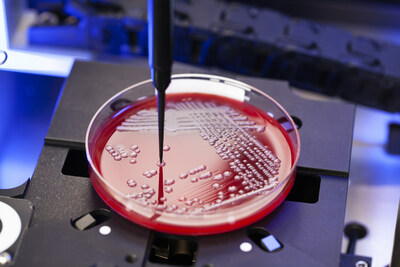 Copan's Colibrtm automatically picks isolated colonies for further workup and investigations. Colonies are selected by the laboratory technologist or automatically by Copan's advanced AI, PhenoMATRIX TAG. The precision robotics of the full laboratory automation system WASPLab combined with Colibrtm help to eliminate transposition errors.