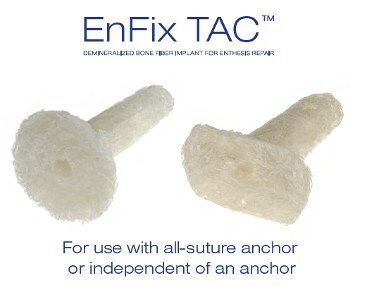 Demineralized Bone Fiber Implant for Enthesis Repair