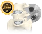 Coverage Expansion Continues for One- and Two-level Lumbar Total Disc Replacement as the Top Commercial Payer in Tennessee Establishes Positive Coverage for Centinel Spine's prodisc® L