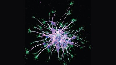 Cytoskeleton in neurons differentiating from induced pluripotent stem cells (courtesy of Torsten Wittmann, Ph.D. from University of California, San Francisco)