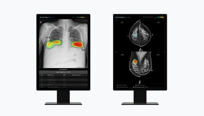 (from left to right) Lunit's AI-powered chest X-ray analysis solution "Lunit INSIGHT CXR" and Lunit's AI solution for mammography analysis "Lunit INSIGHT MMG"