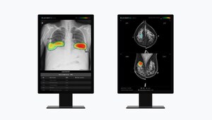 Lunit Expands AI Medical Imaging Solutions in East &amp; Southeast Asia: Partners with Chung Shan Medical University and Gleneagles Hospital Singapore