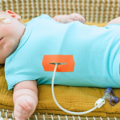 Baby wearing Tabeeze Blue Bottom-Up Bodysuit with Rust Tube-eeze Patch