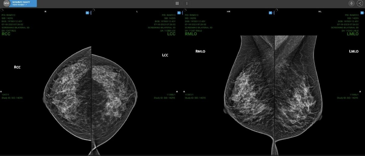 "Progressive Loading" launched on RamSoft's OmegaAI™ Cloud-Native Radiological Software Platform - Vimarsana News