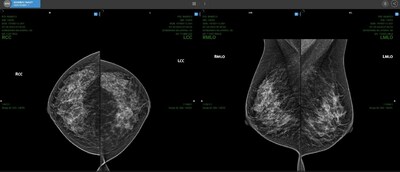 Loading of 4 tomographic Mammography images on the OmegaAI cloud-native RIS/PACS platform in under one second using Progressive Loading. Megabit connectivity is illustrated on a standard browser and PC. (CNW Group/RamSoft Inc.)