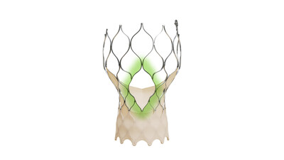 The Medtronic Evolut™ FX+ TAVR system leverages market-leading valve performance with the addition of larger windows to facilitate coronary access.