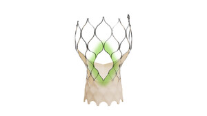 Medtronic announces FDA approval of newest-generation Evolut TAVR system for treatment of symptomatic severe aortic stenosis