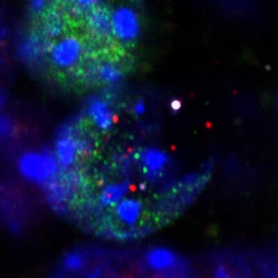 This image shows fragments released from the nuclei of neurons undergoing DNA damage during learning: DNA (large white dot at center right), histones (purple), and transcription factors (red and green).