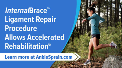 The InternalBracetm procedure augments the primary surgical repair using special anchors to provide additional points of fixation that hold the ligament to a patient's ankle bone while they heal.