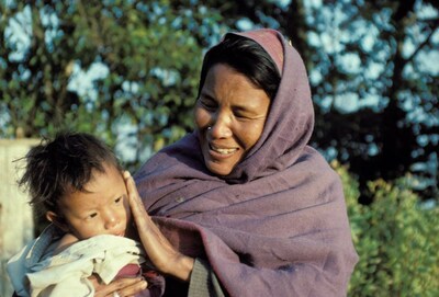 Nepali mother seeing her 2-year-old son for the first time after bilateral cataract surgery by Dr. Martin Spencer for Seva Canada. The mother told Dr. Martin Spencer that he had given her divine eyes. (CNW Group/Seva Canada Society)