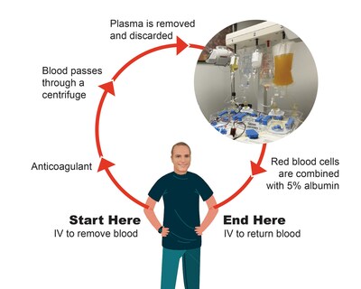 Dr. Paul Savage unveils pioneering plasma exchange protocol: reverses toxins & inflammation