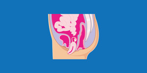 INTIMINA Shares What All Women Need to Know About Pelvic Organ Prolapse