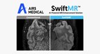 AIRS Medical beschleunigt globale Expansion mit MRT-KI-Lösung SwiftMR™ Lieferverträge in Deutschland und Großbritannien