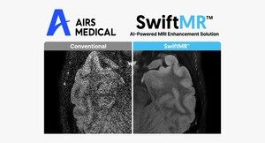 AIRS Medical beschleunigt globale Expansion mit MRT-KI-Lösung SwiftMR™ Lieferverträge in Deutschland und Großbritannien