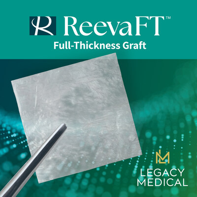 Legacy Medical's Reeva FTtm Full-Thickness Graft