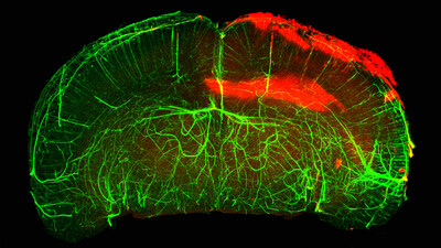 Using three-dimensional imaging technology, the Gladstone team examined blood-brain barrier leaks and distribution of the blood-clotting protein fibrin in a whole intact mouse brain after traumatic brain injury. Fibrin deposits appear in red.