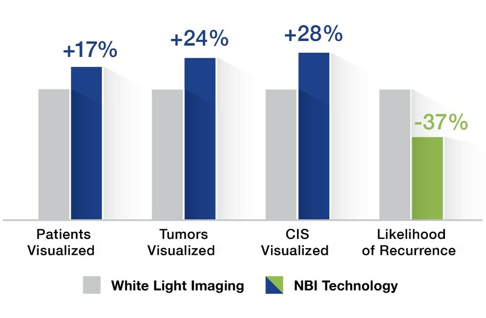 Recurrence Data for Narrow Band Imaging™ (NBI™) Technology Show Value in the Fight Against Non-Muscle Invasive Bladder Cancer - Vimarsana News