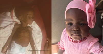Gabi made a remarkable recovery from malnutrition in weeks