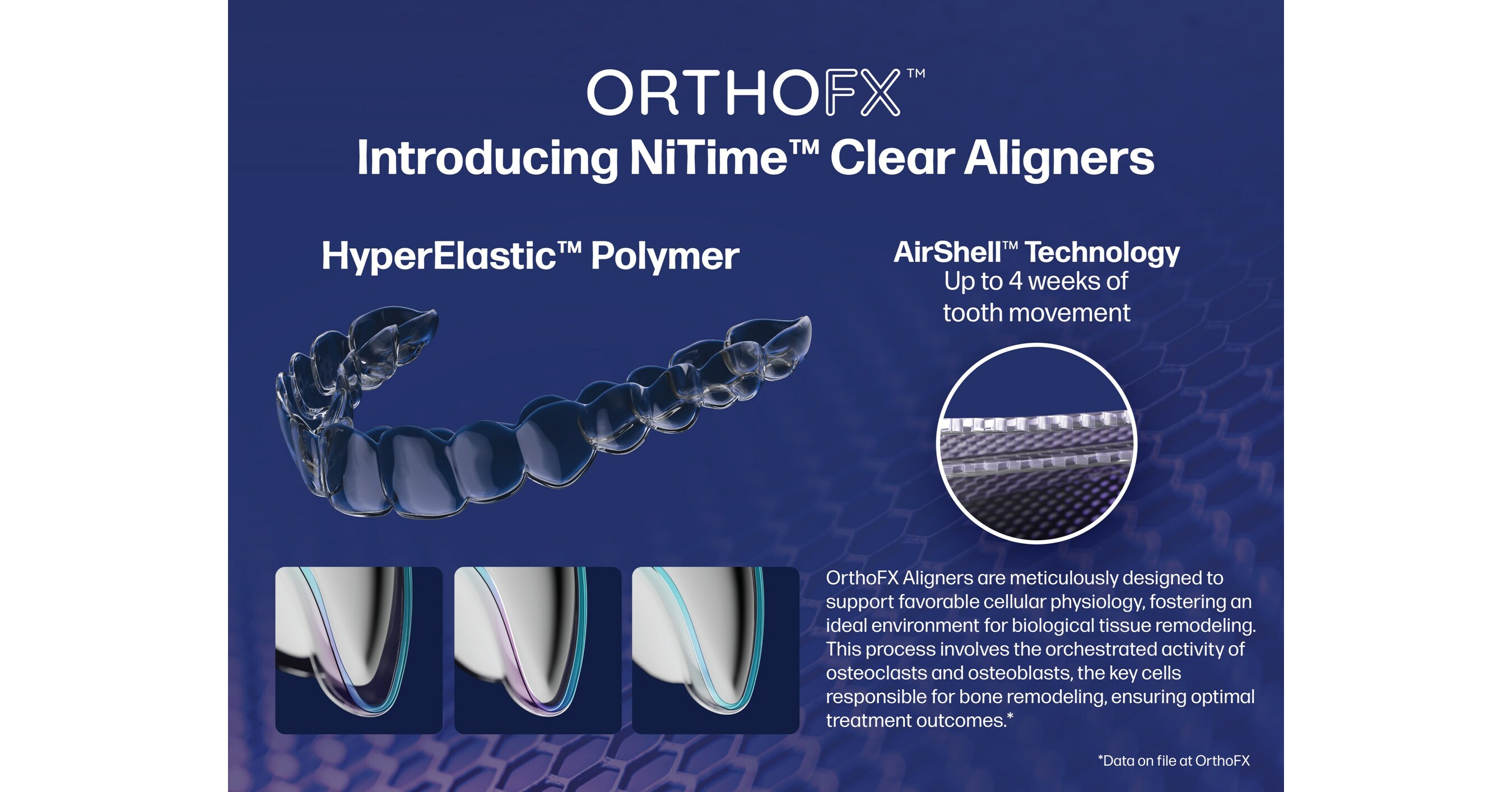 NiTime™-A New Generation Of Clear Aligners Solve for Patient Compliance:  OrthoFX™ Announces Nationwide Availability Of The First and Only FDA  Cleared Aligners Designed Explicitly For Shorter Wear Time