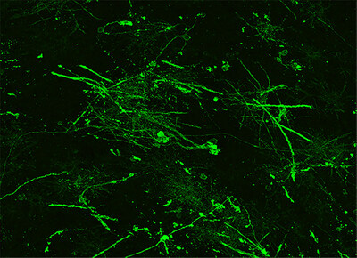 In human organoid cells, ESI1 treatment strengthened myelin sheath production, as shown by the thick, long green strands. in this confocal microscope image.