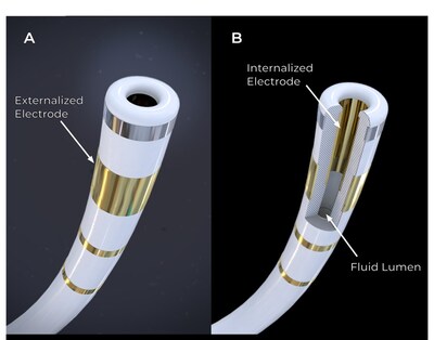 Field Medical's FieldForcetm Catheter tip (A). The FieldBendingtm technology utilizes an innovative internalized electrode within a fluid lumen seen in the cutaway (B). Voltage is delivered between the external and internal electrodes resulting in desirable electric field characteristics. The FieldForcetm Catheter is the first and only contact force PFA catheter optimized for the ventricles. 