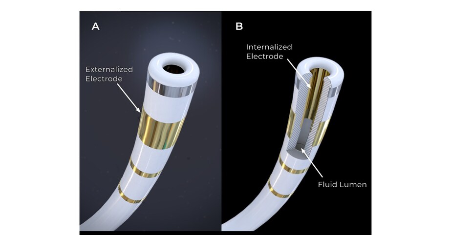 Field Medical oznamuje první studie na lidech průkopnické technologie FieldForce™ ventrikulární pulzní ablace pole