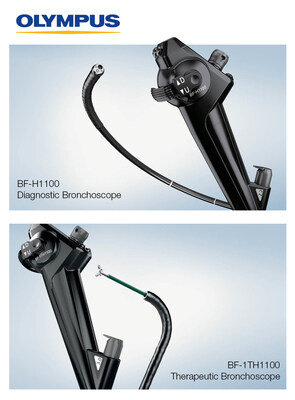 Olympus announced the launch of two bronchoscopes as part of the EVIS X1 endoscopy system. The diagnostic and therapeutic bronchoscopes offer slim outer diameters compared to their predecessors and large working channels.