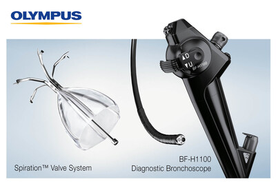 During the annual American Thoracic Society meeting in San Diego, Olympus will highlight an AI-powered emphysema screening program and two recently launched bronchoscopes compatible with the EVIS X1™ endoscopy system.