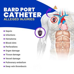 Advocate Rights Center Launches Guide for Bard PowerPort Leads, Marketing, and Intake